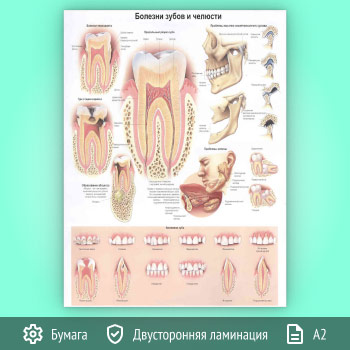 Плакат «Болезни зубов и челюсти» (ЗОЖ-32, 1 лист, А2)